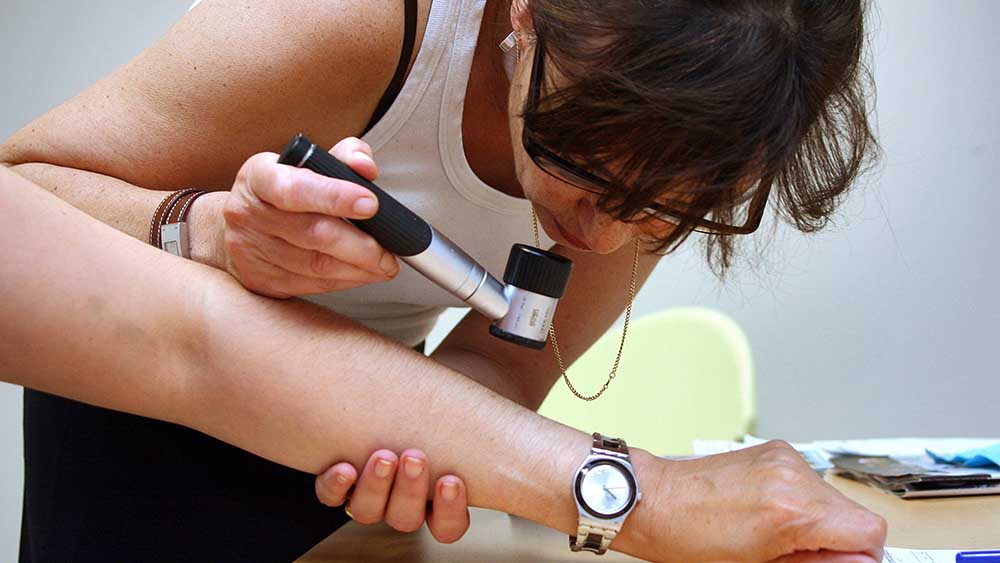 Ärztin untersucht Arm eines Patienten mit Lupe